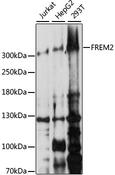 Western blot - FREM2 Polyclonal Antibody 