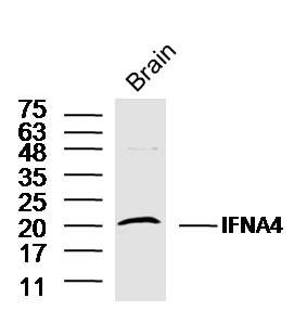 Fig2: Sample:; Brain (Mouse) Lysate at 40 ug; Primary: Anti- IFNA4 at 1/300 dilution; Secondary: IRDye800CW Goat Anti-Rabbit IgG at 1/20000 dilution; Predicted band size: 22 kD; Observed band size: 20 kD