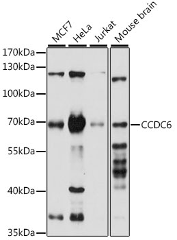 Western blot - CCDC6 Polyclonal Antibody 
