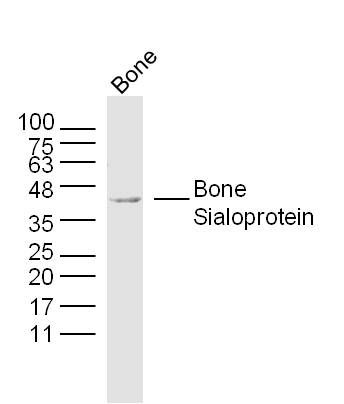 Fig1: Sample:; Bone (Mouse) Lysate at 40 ug; Primary: Anti- Bone Sialoprotein at 1/300 dilution; Secondary: IRDye800CW Goat Anti-Rabbit IgG at 1/20000 dilution; Predicted band size: 35 kD; Observed band size: 35kD
