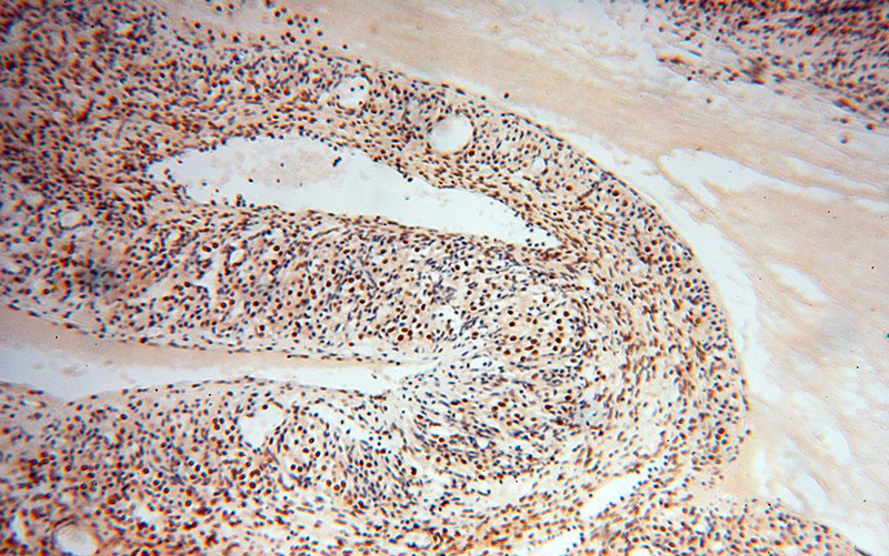 Immunohistochemical of paraffin-embedded human ovary using Catalog No:108378(BBX antibody) at dilution of 1:100 (under 10x lens)