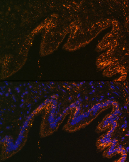 Immunofluorescence - SCNN1A Polyclonal Antibody 