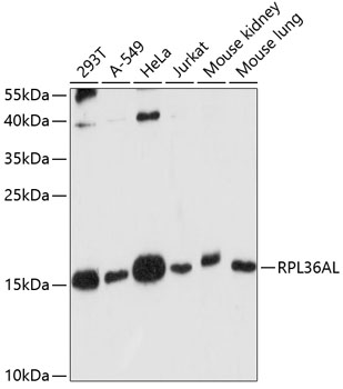 Western blot - RPL36AL Polyclonal Antibody 
