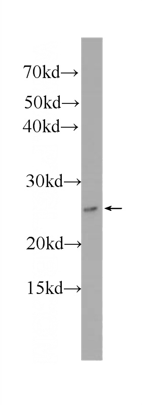 HeLa cells were subjected to SDS PAGE followed by western blot with Catalog No:107655(ubiquitin Antibody) at dilution of 1:1000