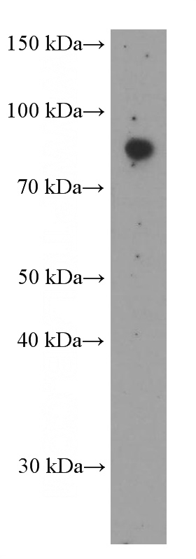 HEK-293 cells were subjected to SDS PAGE followed by western blot with Catalog No:107521(SDCCAG8 Antibody) at dilution of 1:1000