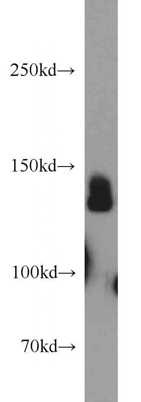 mouse brain tissue were subjected to SDS PAGE followed by western blot with Catalog No:111368(HCN4 antibody) at dilution of 1:500