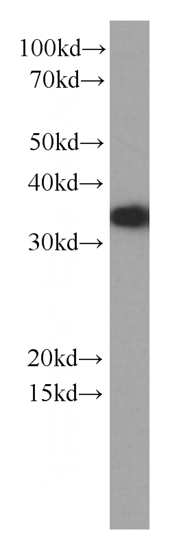 HEK-293 cells were subjected to SDS PAGE followed by western blot with Catalog No:107248(EEF1B2 Antibody) at dilution of 1:2000