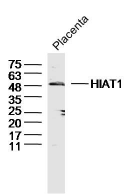Fig1: Sample: Placenta (Mouse) Lysate at 40 ug; Primary: Anti-HIAT1 at 1/300 dilution; Secondary: IRDye800CW Goat Anti-Rabbit IgG at 1/20000 dilution; Predicted band size: 53kD; Observed band size: 50kD