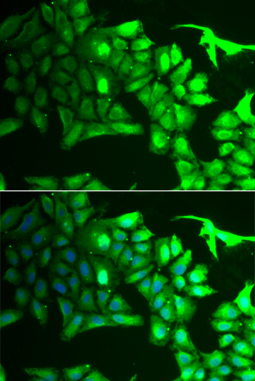 Immunofluorescence - AIPL1 Polyclonal Antibody 