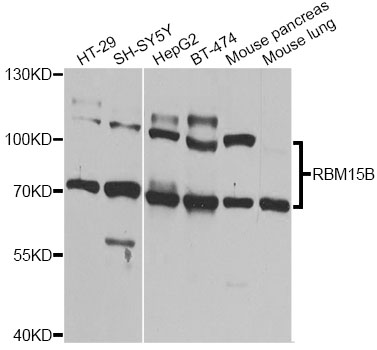 Western blot - RBM15B Polyclonal Antibody 