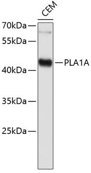 Western blot - PLA1A Polyclonal Antibody 