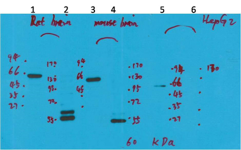 Fig1:; Western blot analysis of 1) Rat Brain Tissue-Low Molecular Protein Marker, 2)Rat Brain Tissue-High Molecular Protein Marker, 3) Mouse Brain Tissue-Low Molecular Protein Marker, 4) Mouse Brain Tissue- High Molecular Protein Marker, 5) HepG2-Low Molecular P