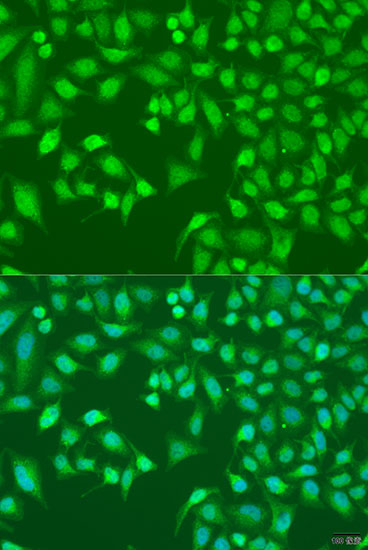 Immunofluorescence - TRIM22 Polyclonal Antibody 