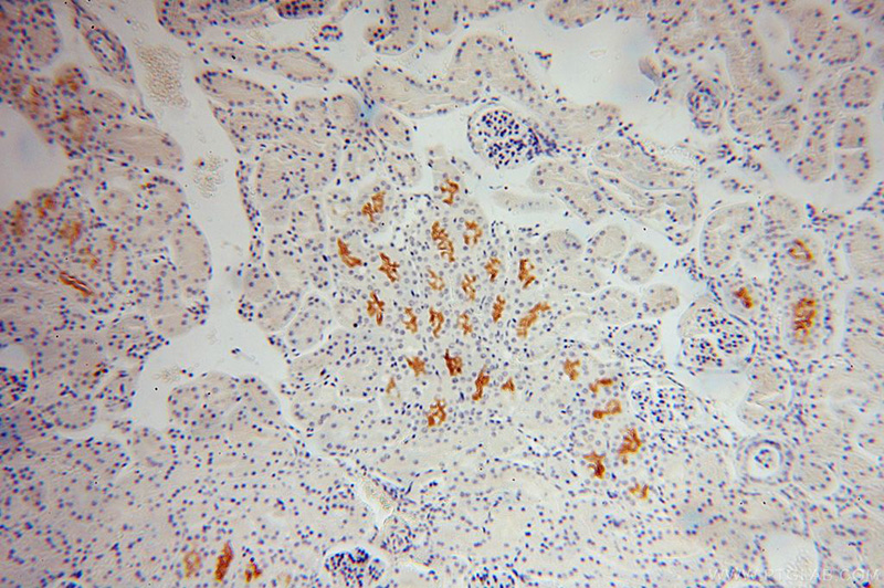Immunohistochemical of paraffin-embedded human kidney using Catalog No:115376(SLC3A1 antibody) at dilution of 1:100 (under 10x lens)
