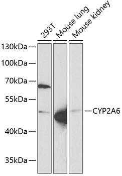 Western blot - CYP2A6 Polyclonal Antibody 