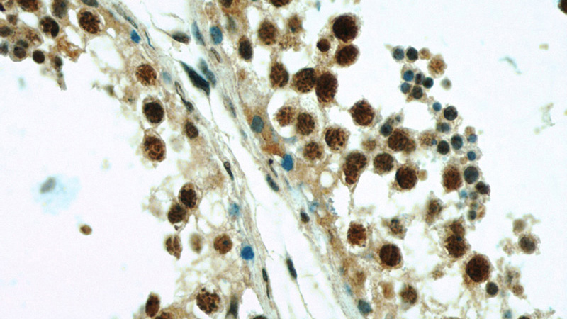 Immunohistochemistry of paraffin-embedded human testis slide using Catalog No:117159(ZNF311 Antibody) at dilution of 1:50