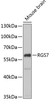 Western blot - RGS7 Polyclonal Antibody 