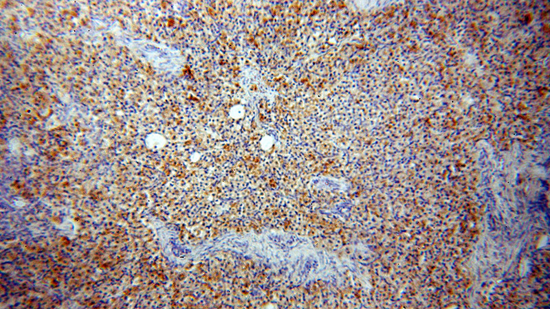 Immunohistochemical of paraffin-embedded human ovary using Catalog No:108642(C11orf67 antibody) at dilution of 1:50 (under 10x lens)
