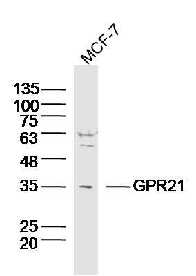 Fig1: Sample:MCF-7 (Human)cell Lysate at 40 ug; Primary: Anti-GPR21 at 1/300 dilution; Secondary: IRDye800CW Goat Anti-RabbitIgG at 1/20000 dilution; Predicted band size: 38kD; Observed band size: 35kD