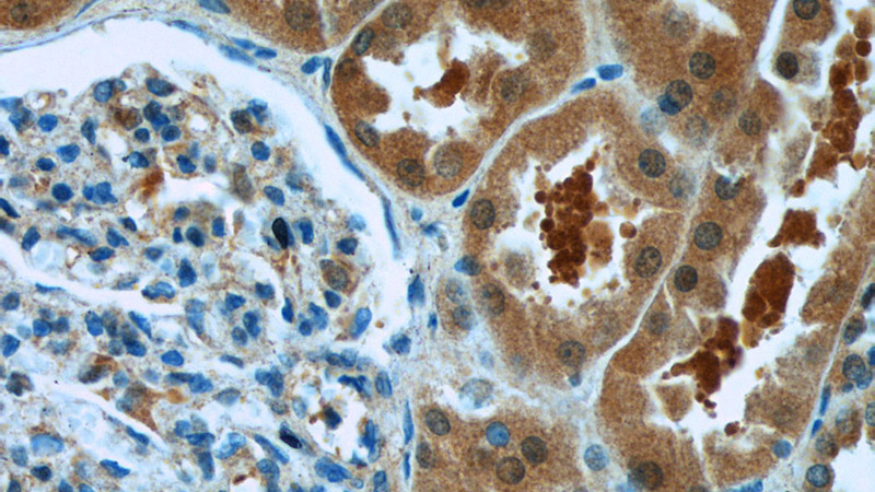 Immunohistochemistry of paraffin-embedded human kidney tissue slide using Catalog No:113584(PARK7,DJ-1 Antibody) at dilution of 1:50 (under 40x lens)