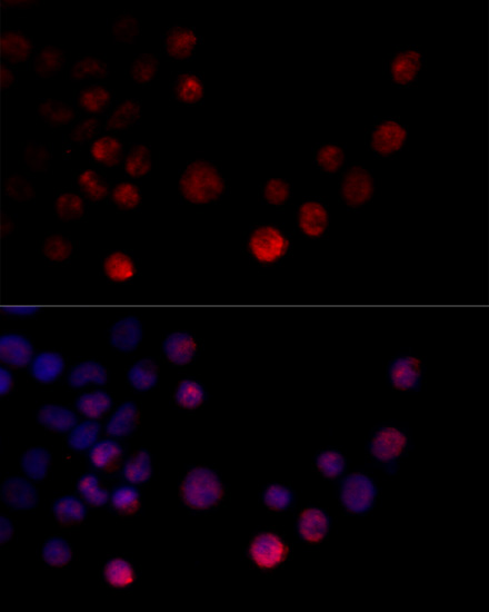 Immunofluorescence - HNRNPH2 Polyclonal Antibody 
