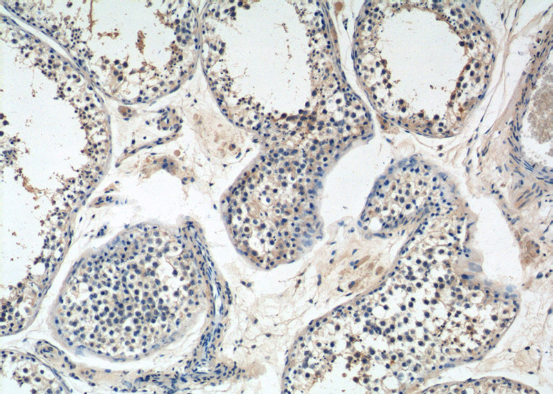 Immunohistochemistry of paraffin-embedded human testis tissue slide using Catalog No:116867(WDR40A Antibody) at dilution of 1:50 (under 10x lens)
