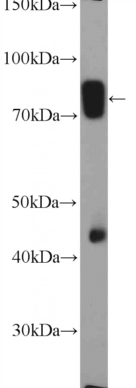 mouse liver tissue were subjected to SDS PAGE followed by western blot with Catalog No:111334(HAL Antibody) at dilution of 1:300