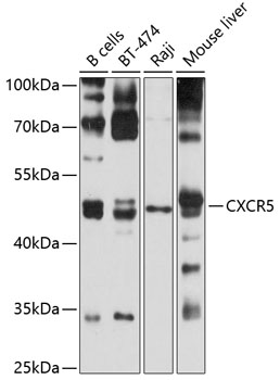 Western blot - CXCR5 Polyclonal Antibody 