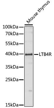Western blot - LTB4R Polyclonal Antibody 