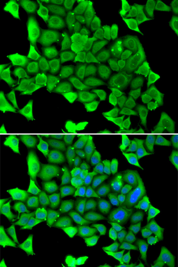 Immunofluorescence - MYH1 Polyclonal Antibody 