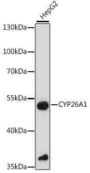Western blot - CYP26A1 Polyclonal Antibody 