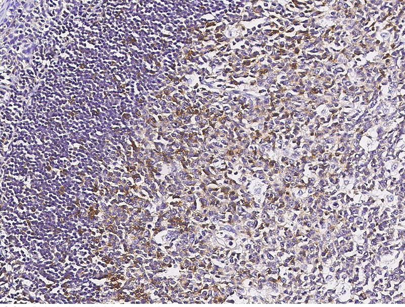 LFA-1 / CD11a / ITGAL / Integrin alpha L Antibody, Rabbit PAb, Antigen Affinity Purified, Immunohistochemistry