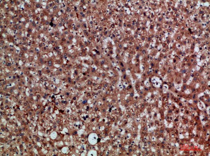 Fig1:; Immunohistochemical analysis of paraffin-embedded human-liver, antibody was diluted at 1:200
