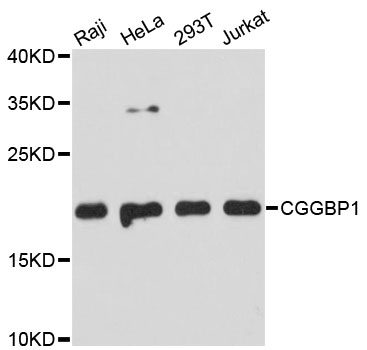 Western blot - CGGBP1 Polyclonal Antibody 