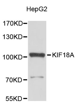 Western blot - KIF18A Polyclonal Antibody 