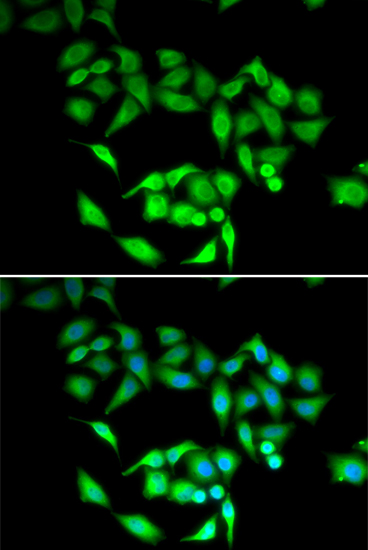 Immunofluorescence - CCT3 Polyclonal Antibody 