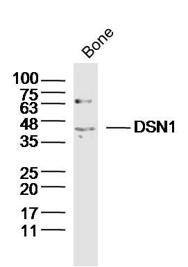 Fig1: Sample: Bone (Mouse) Lysate at 40 ug; Primary: Anti-DSN1 at 1/300 dilution; Secondary: IRDye800CW Goat Anti-Rabbit IgG at 1/20000 dilution; Predicted band size: 40kD; Observed band size: 40kD
