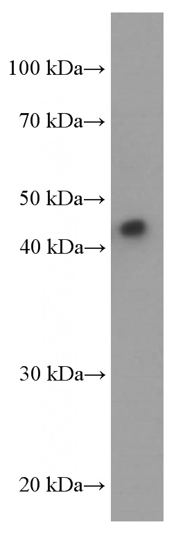 human plasma tissue were subjected to SDS PAGE followed by western blot with Catalog No:107438(ORM2 Antibody) at dilution of 1:1000