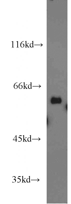 mouse liver tissue were subjected to SDS PAGE followed by western blot with Catalog No:113622(PDIA5 antibody) at dilution of 1:1500