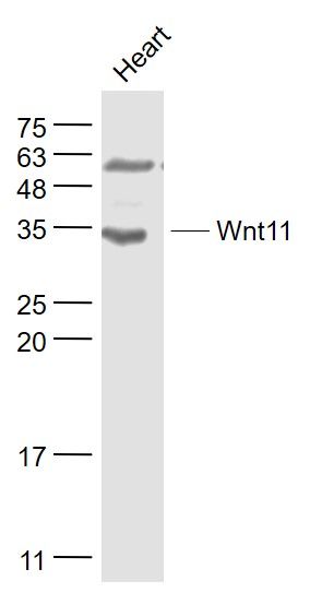 Fig1: Sample:; Heart (Mouse) Lysate at 40 ug; Primary: Anti- Wnt11 at 1/1000 dilution; Secondary: IRDye800CW Goat Anti-Rabbit IgG at 1/20000 dilution; Predicted band size: 36 kD; Observed band size: 34 kD