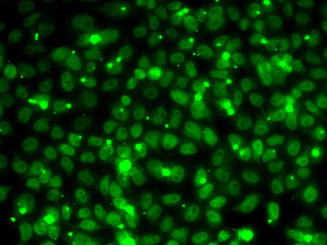 Immunofluorescence - RPA3 Polyclonal Antibody 