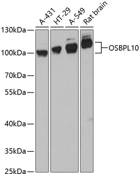 Western blot - OSBPL10 Polyclonal Antibody 