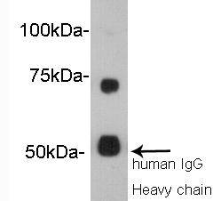 Fig1: Western blot analysis on human serum using anti- Vitamin K-dependent protein S polyclonal antibody.
