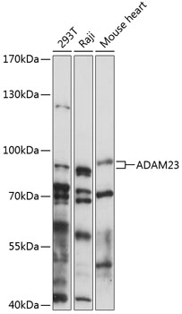 Western blot - ADAM23 Polyclonal Antibody 