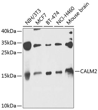 Western blot - CALM2 Polyclonal Antibody 