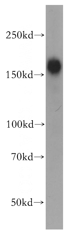 mouse skeletal muscle tissue were subjected to SDS PAGE followed by western blot with Catalog No:112994(MYOM3 antibody) at dilution of 1:500