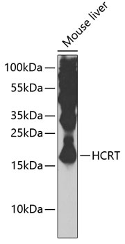 Western blot - HCRT Polyclonal Antibody 