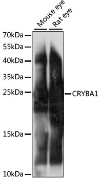 Western blot - CRYBA1 Polyclonal Antibody 