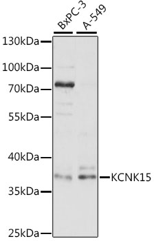 Western blot - KCNK15 Polyclonal Antibody 