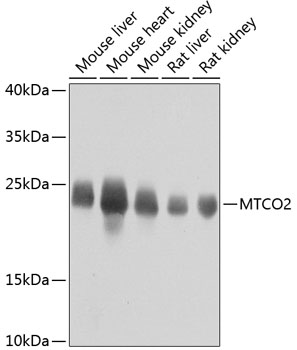 Western blot - MTCO2 Polyclonal Antibody 